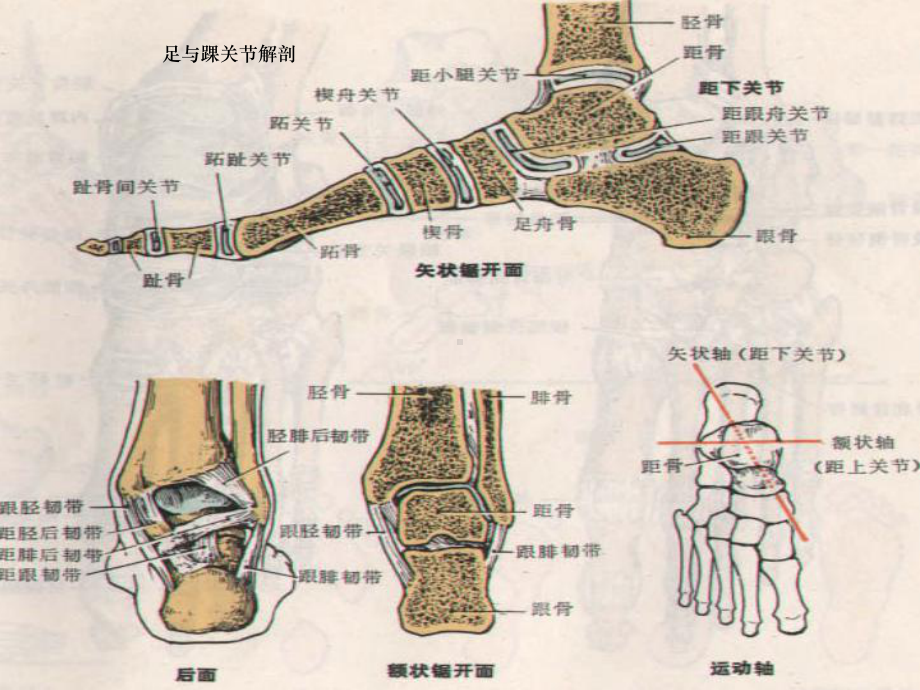 骨科个案踝关节骨折病人护理课件.ppt_第3页