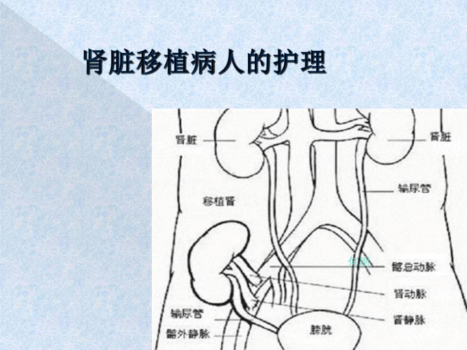 肾移植的护理课件.ppt_第1页