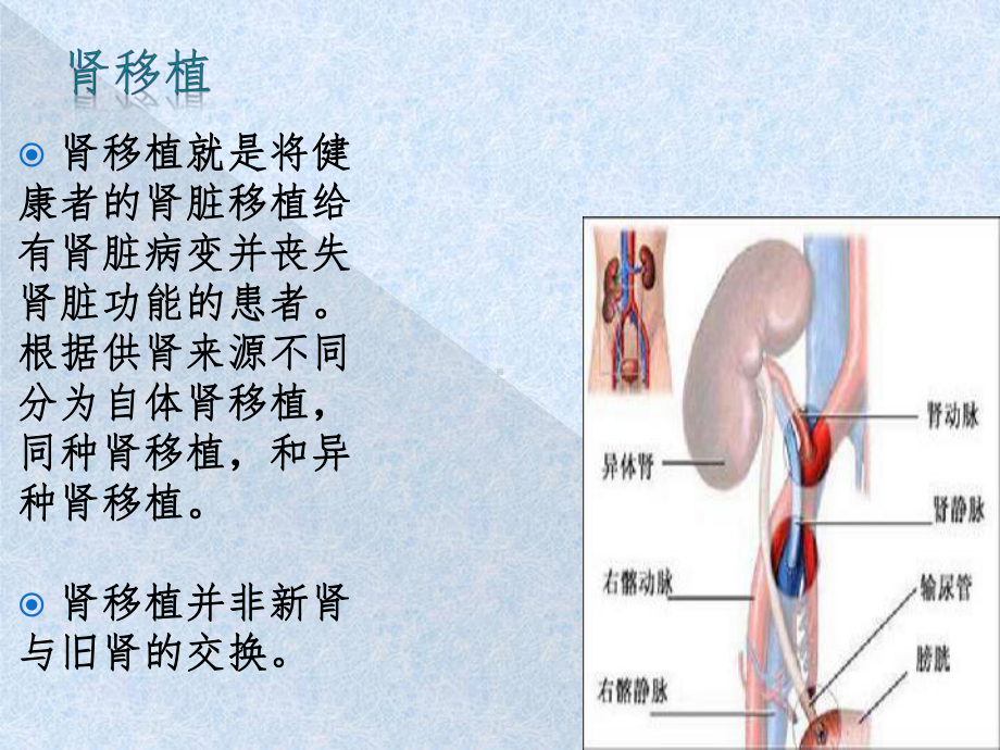 肾移植的护理课件.ppt_第3页