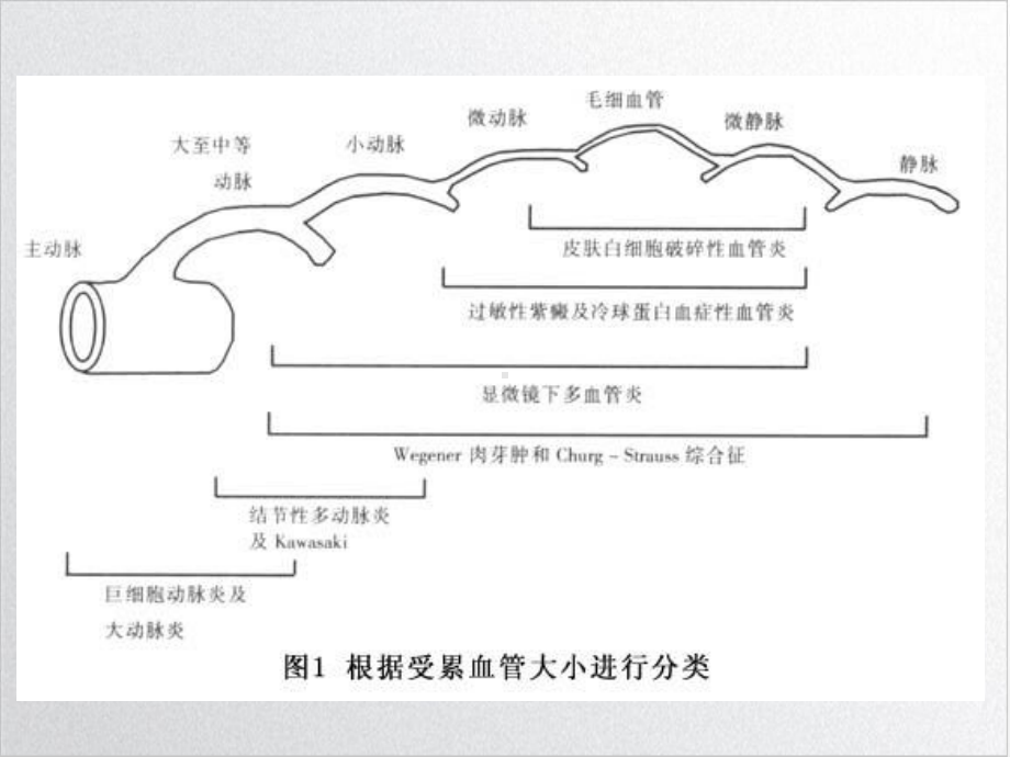 血管炎患者的治疗与护理实用版课件.ppt_第3页