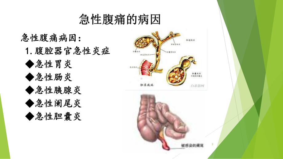 腹痛的护理参考课件.ppt_第3页