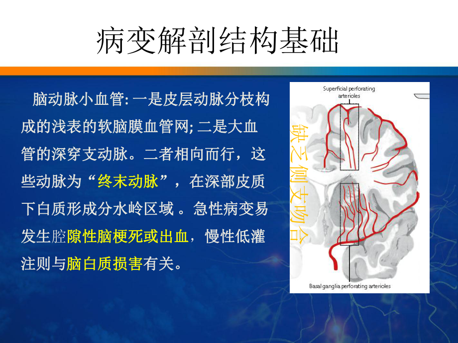 脑小血管病课件.pptx_第3页