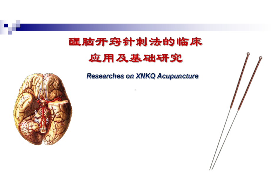 醒脑开窍针刺法的临床应用及基础研究课件.ppt_第1页