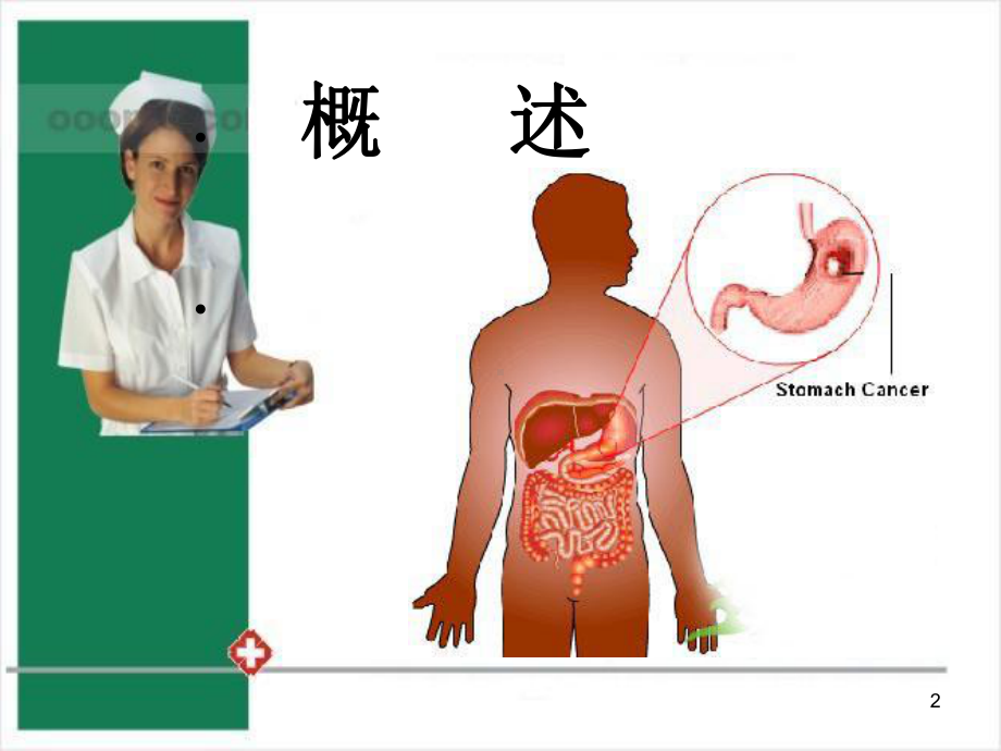 胃切除术后饮食护理参考课件.ppt_第2页