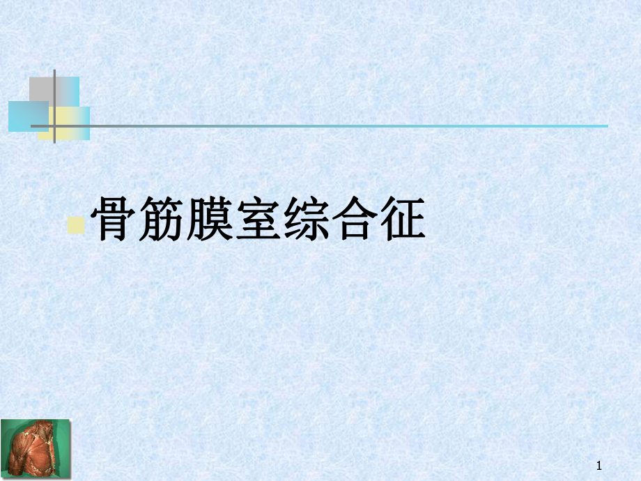 骨筋膜室综合征选编课件.ppt_第1页