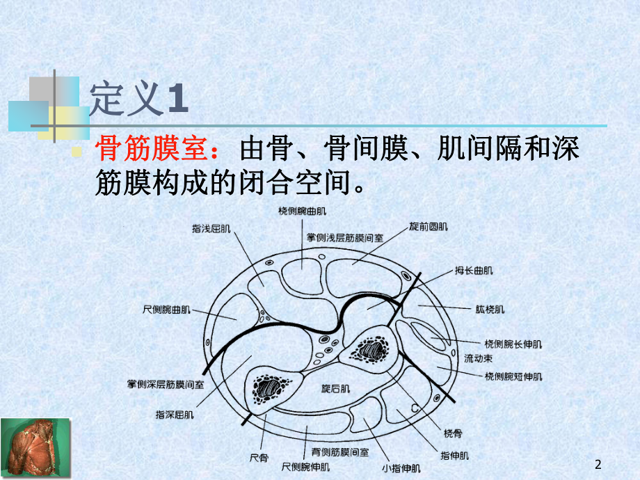 骨筋膜室综合征选编课件.ppt_第2页