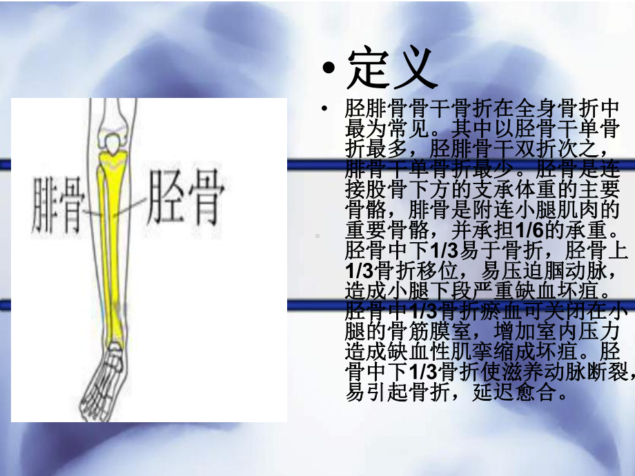 胫腓骨骨折围手术期的护理课件.ppt_第3页