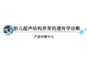 胎儿超声结构异常的遗传学诊断课件.ppt