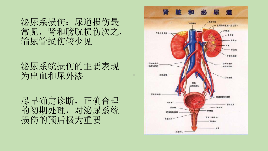 肾损伤CT诊断资料讲解课件.pptx_第2页