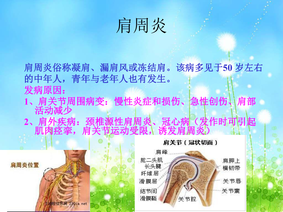 骨科常见疾病预防课件.ppt_第3页