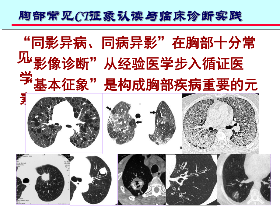 肺部ct十大征象诊断应用35675-课件.ppt_第2页