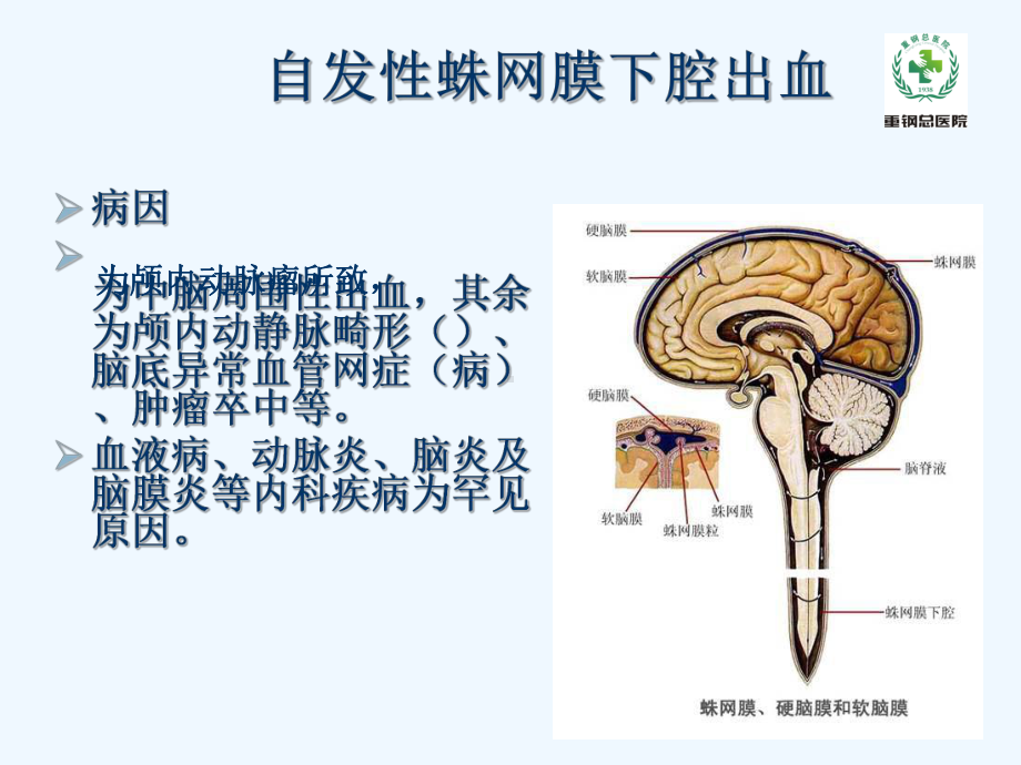 自发性蛛网膜下腔出血课件.ppt_第3页