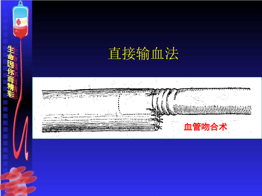 输血严重危害shot课件.ppt_第3页