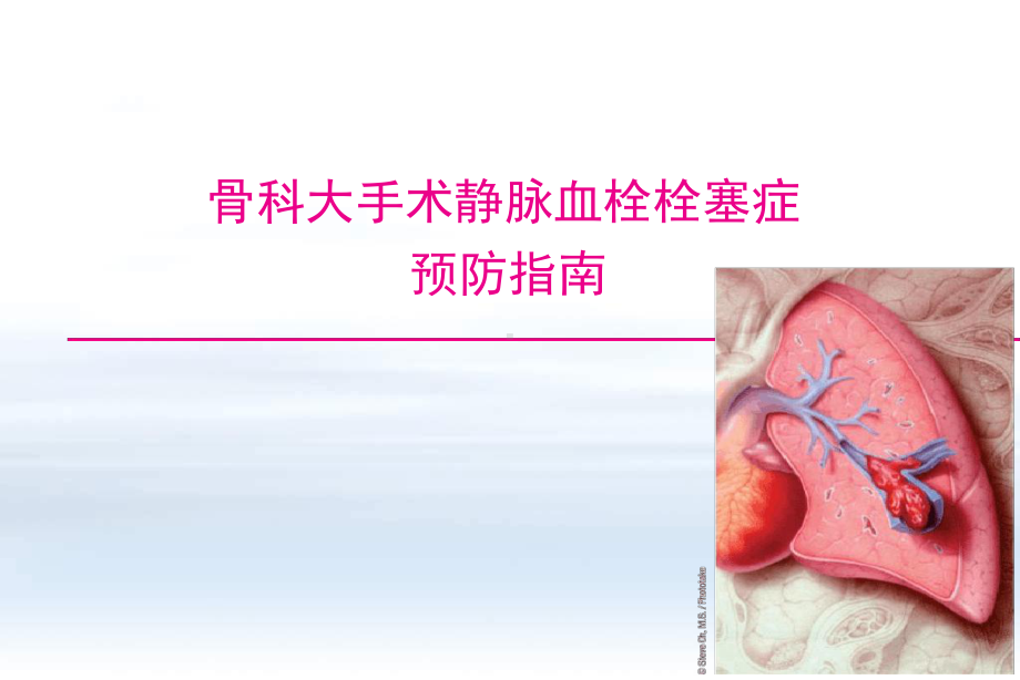 静脉血栓栓塞症预防指南-21课件.ppt_第1页