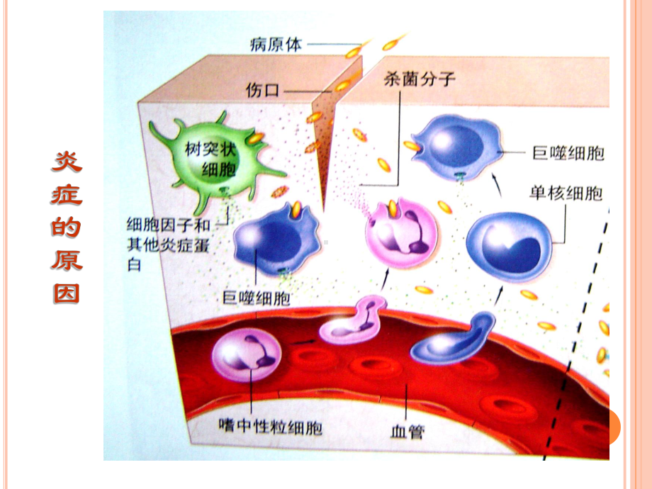 非甾体类药物的合理应用教学课件.ppt_第2页