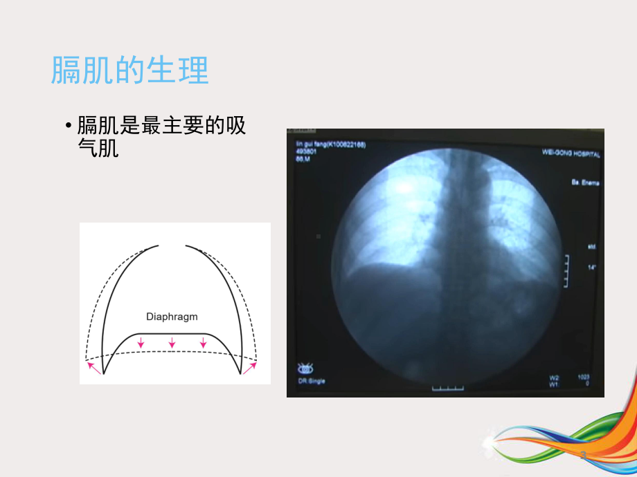 膈肌超声评估学习课件.ppt_第3页