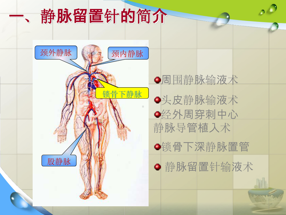 静脉留置针常见并发症预防及护理课件(模板).pptx_第2页