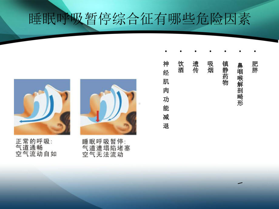 阻塞性睡眠呼吸暂停综合征的健康教育汇编课件.ppt_第3页