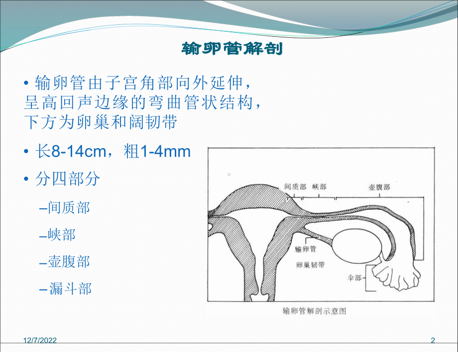 输卵管炎性疾病的超声诊断参考课件.ppt_第2页