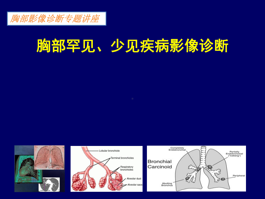 胸部少见罕见疾病影像诊断课件.ppt_第1页