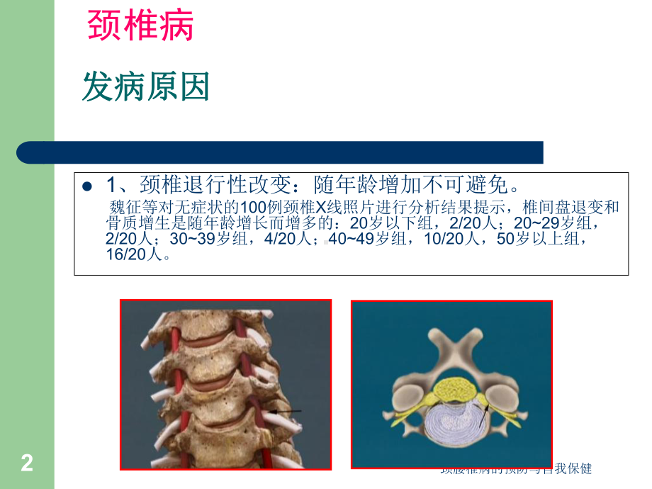 颈腰椎病的预防与自我保健课件.ppt_第2页