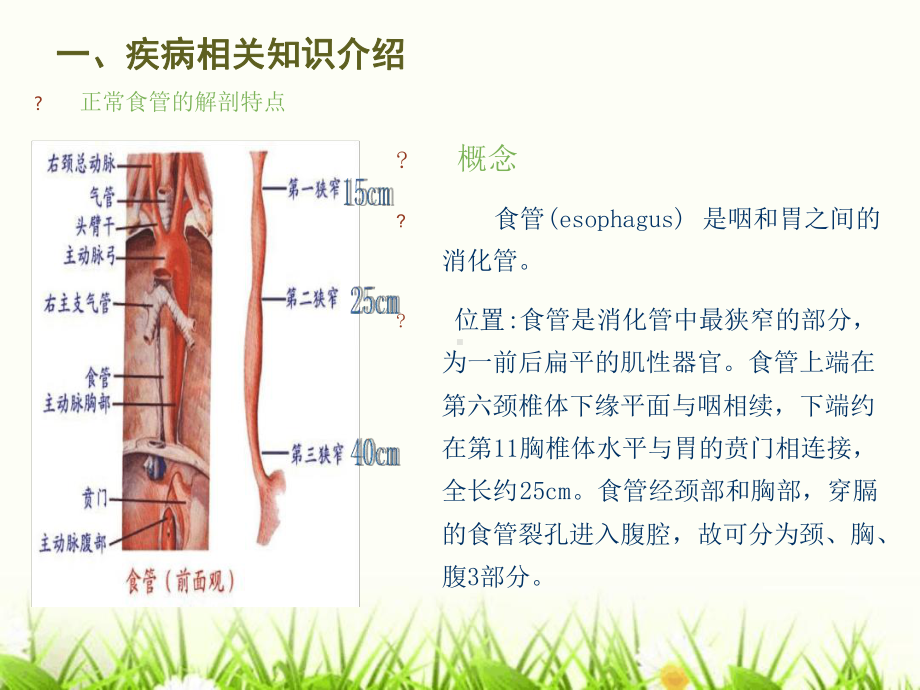 食道癌个案查房课件.ppt_第3页