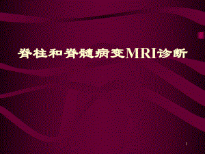 脊椎MR-ppt课件.ppt