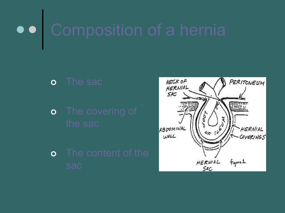 hernia分析课件共50页文档.ppt_第3页