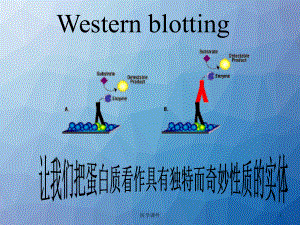 Western-blot原理和技术-ppt课件.ppt