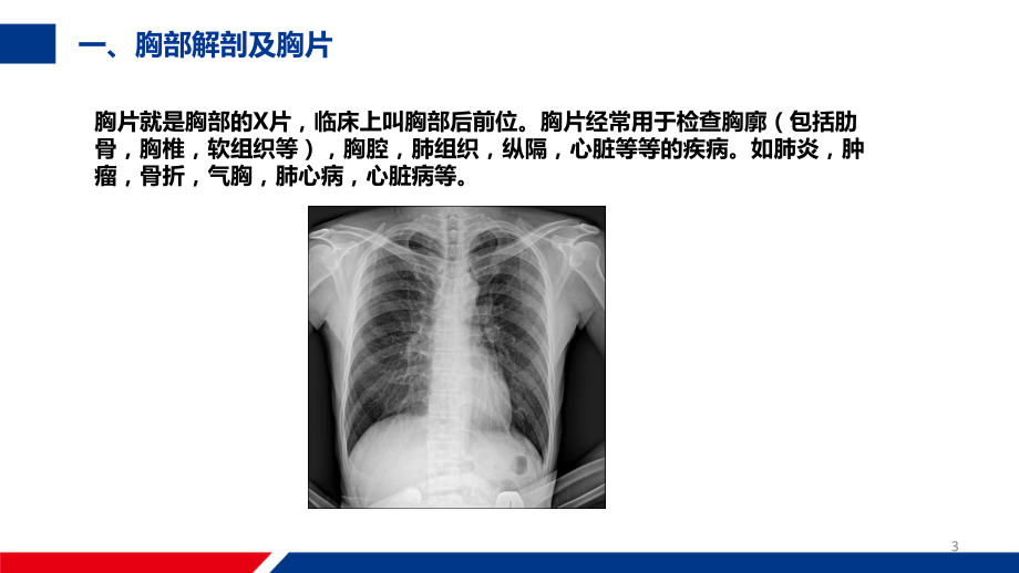 DR影像评价常见方法ppt课件.pptx_第3页