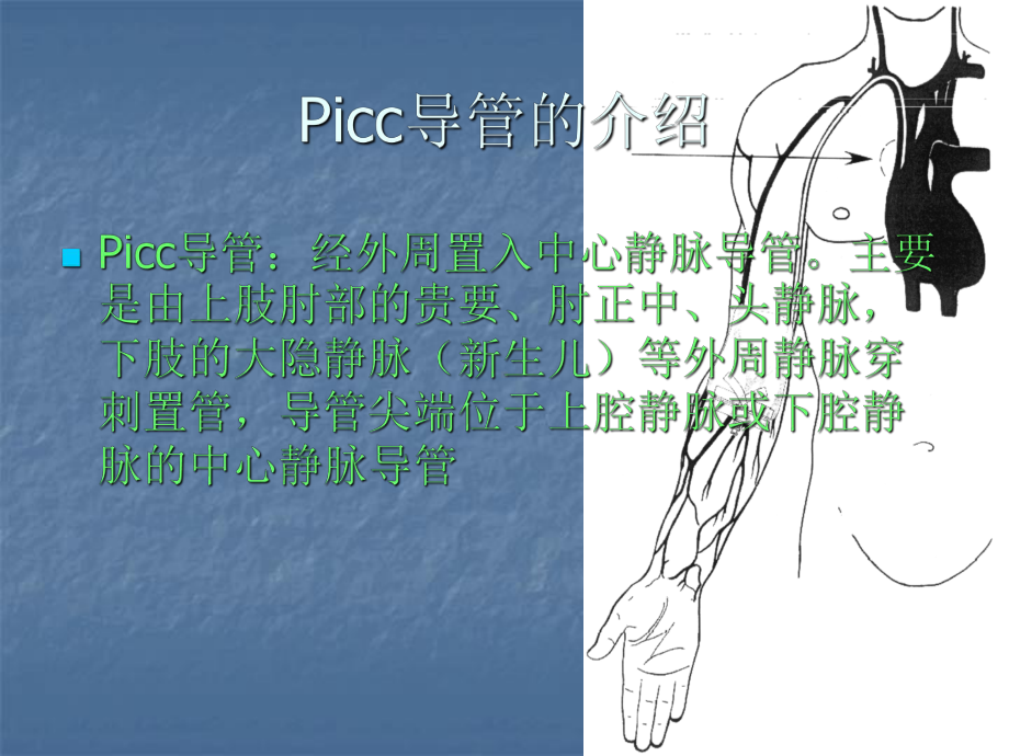 PICC导管的维护ppt课件(同名58332).ppt_第2页