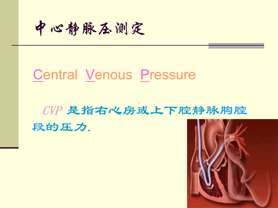 中心静脉压测定-ppt课件.ppt_第2页