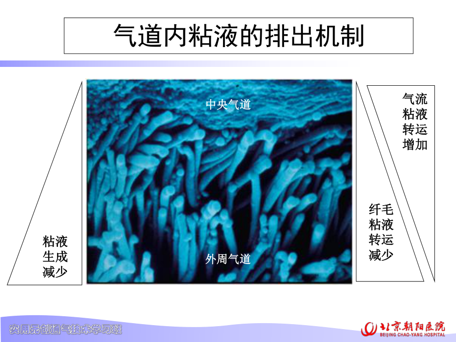 无创机械通气患者的气道净化PPT培训课件.ppt_第3页