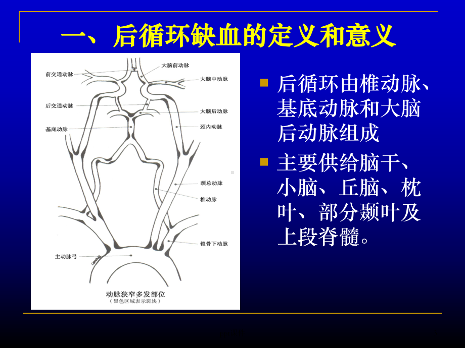 后循环缺血-ppt课件.ppt_第3页