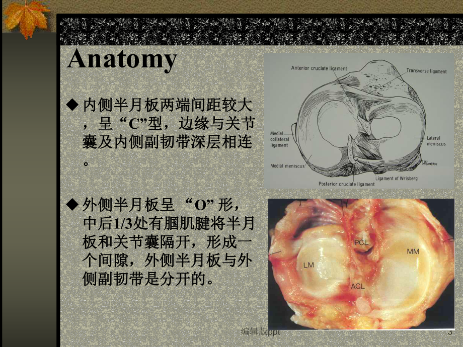 半月板损伤的诊断与治疗医学PPT课件.ppt_第3页