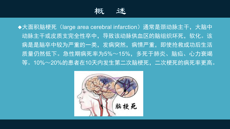 大面积脑梗塞PPT课件.pptx_第2页