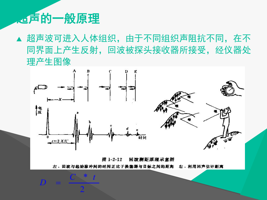 肺部超声技术在ARDS患者应用价值-ppt课件.ppt_第3页