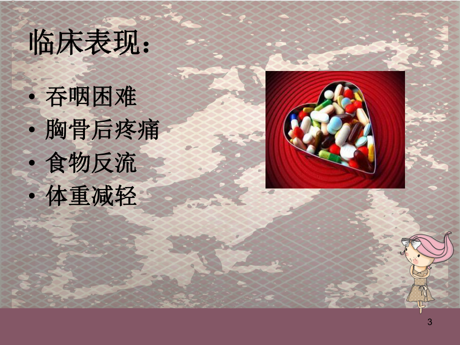 贲门失弛缓症经口内镜下肌切开术(POEM)PPT课件.ppt_第3页