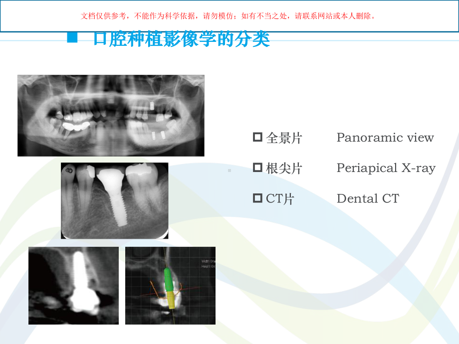 种植影像学分析培训课件.ppt_第2页