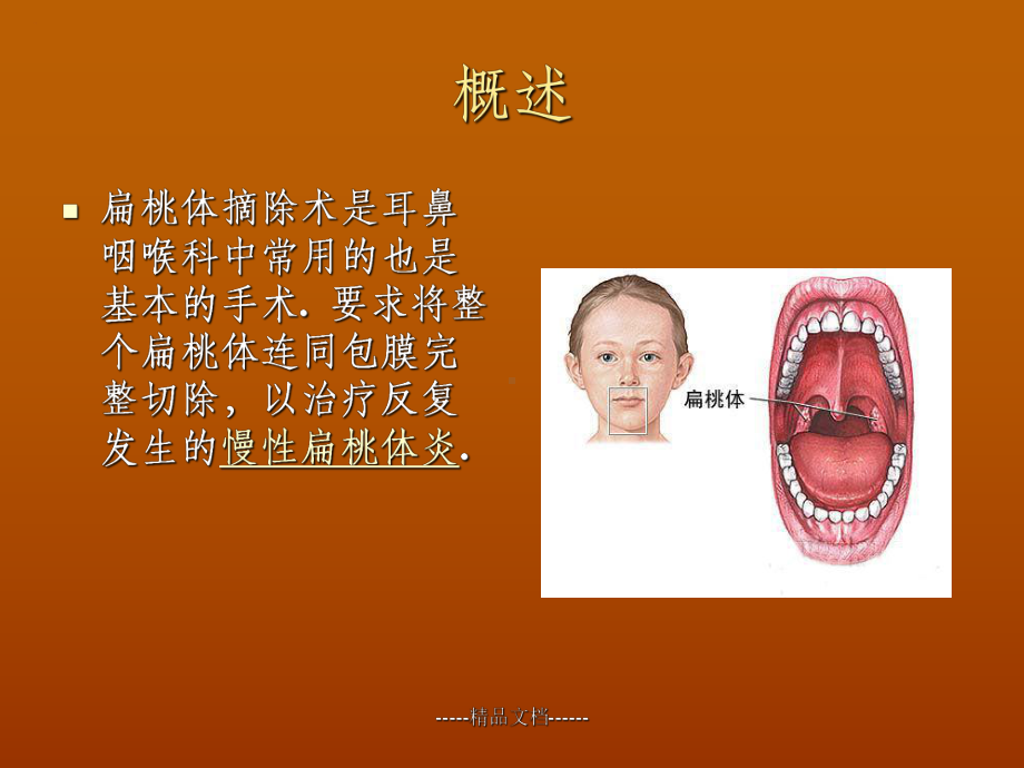 扁桃体切除术围手术后的护理课件.ppt_第2页