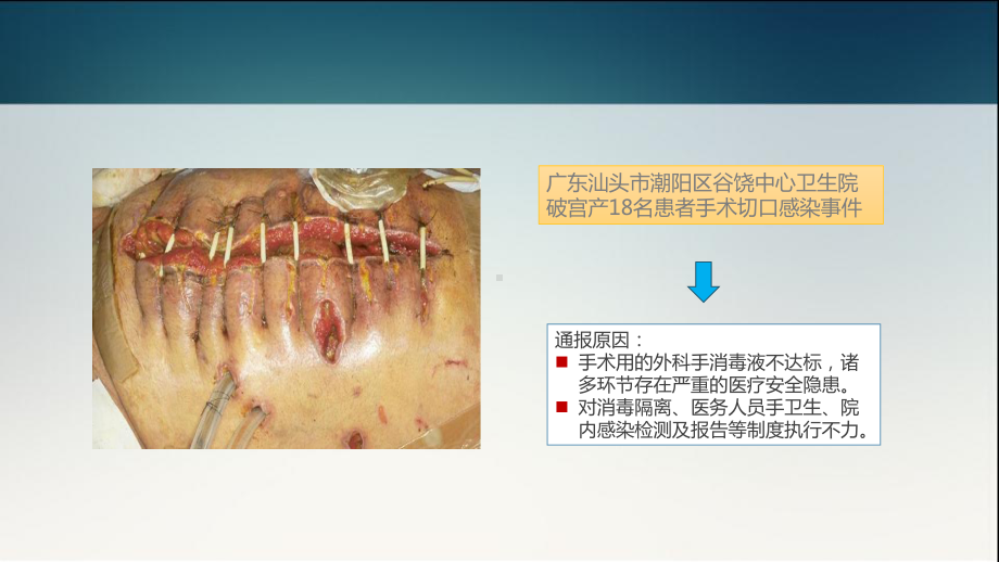 对患者的手卫生教育-ppt课件.ppt_第3页