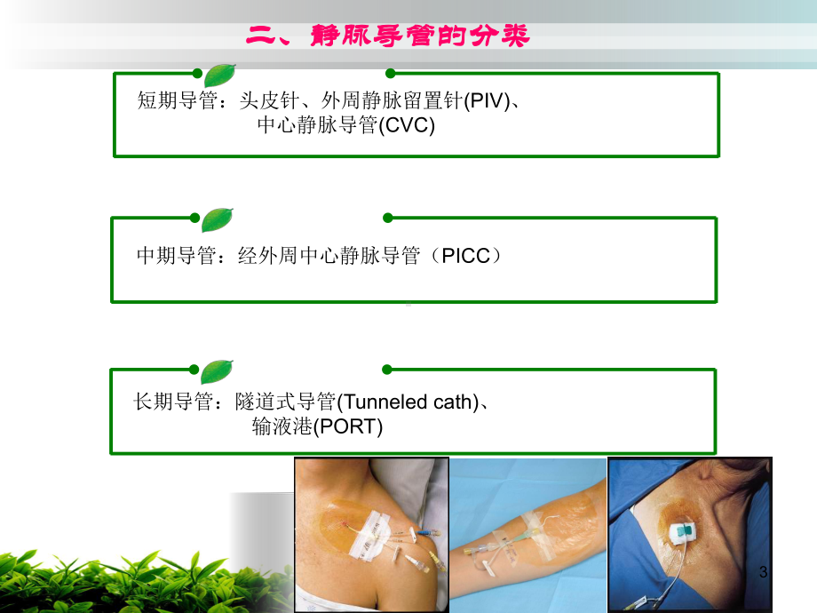 静脉导管的应用PPT课件.ppt_第3页