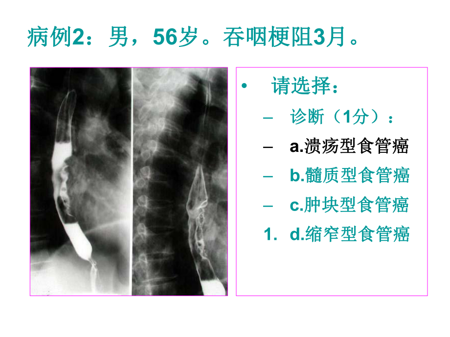 医师资格考试技能影像试题课件.ppt_第3页