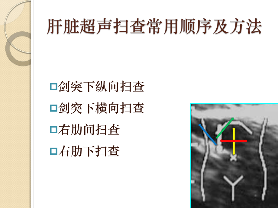 常用超声扫查方法及标准切面-PPT精品课件.pptx_第3页