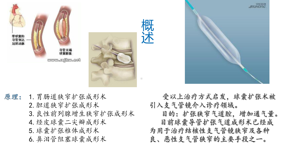 球囊导管扩张技术ppt课件(同名69463).ppt_第3页