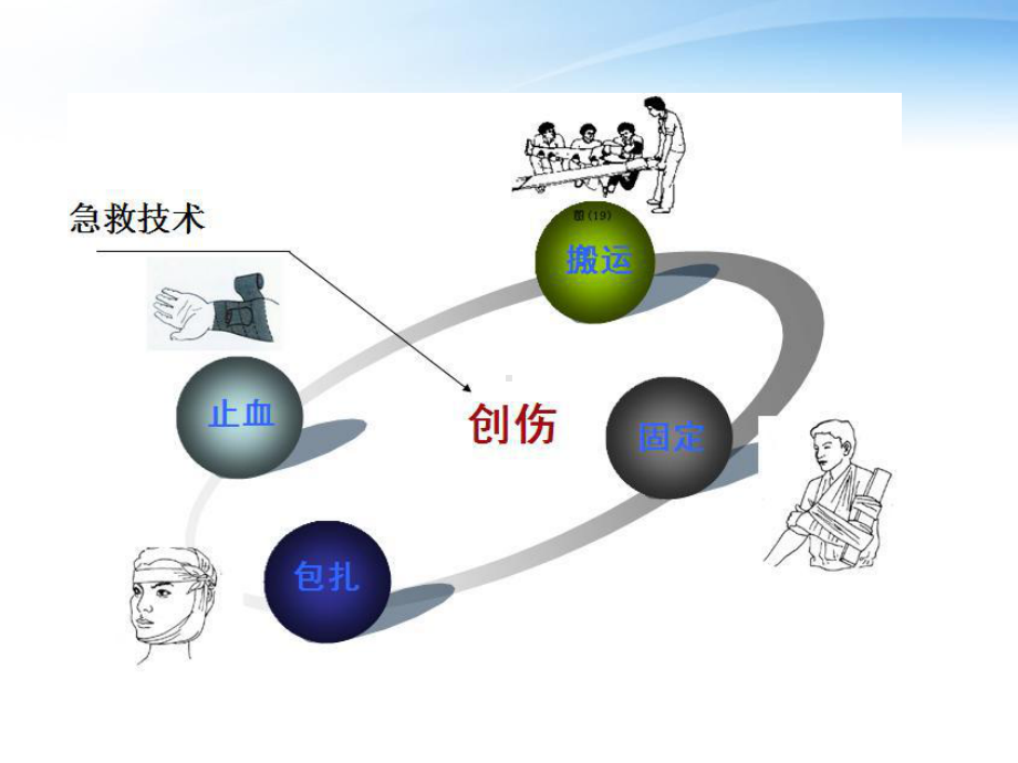 止血、包扎、固定、搬运术-ppt课件.ppt_第2页