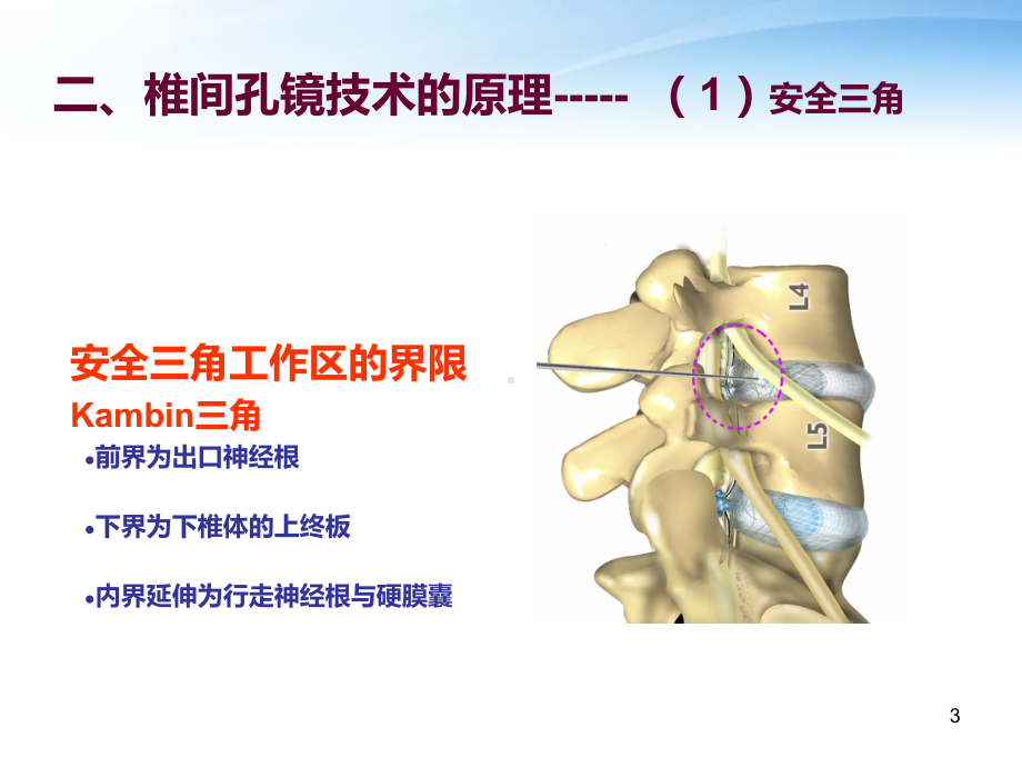 椎间孔镜PPT课件.ppt_第3页