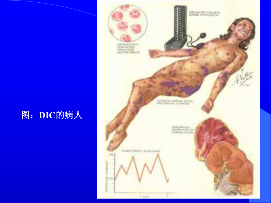 病理生理学-绪论课件.ppt_第3页