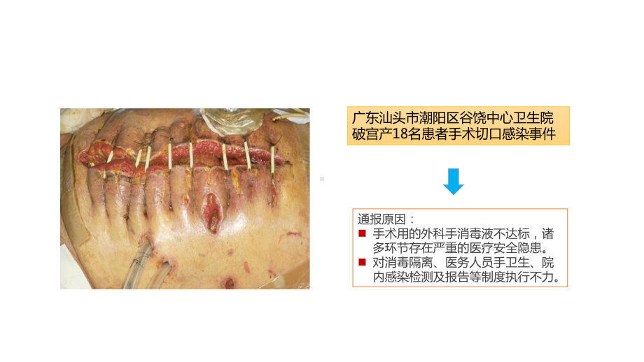 对患者的手卫生教育-PPT课件.ppt_第3页