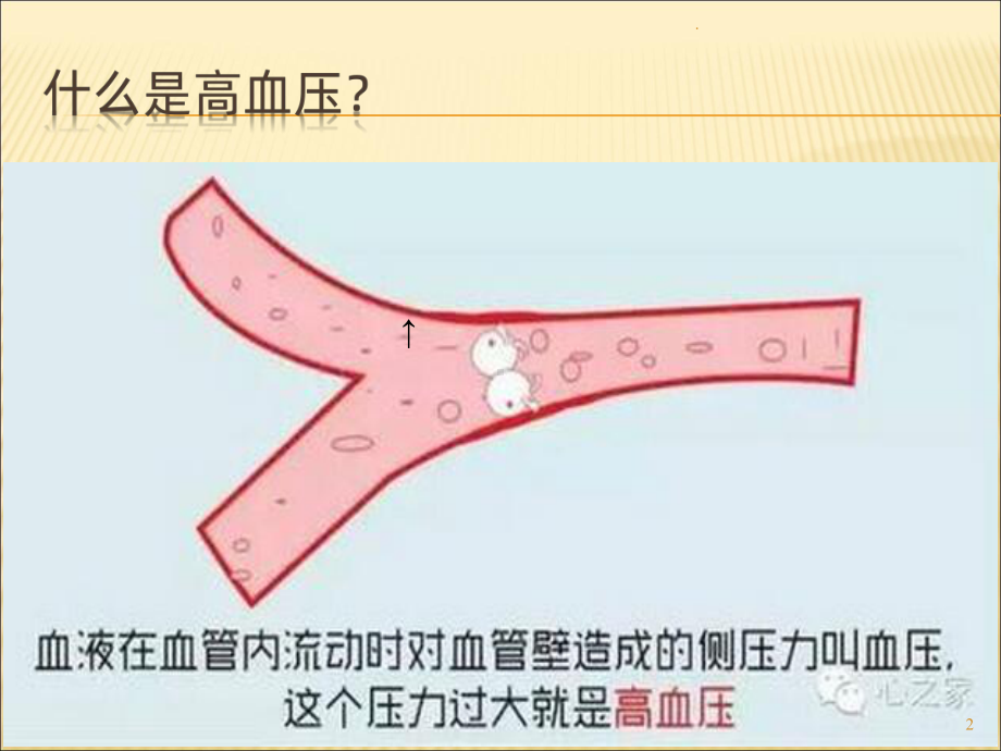 血压管理(PPT课件)(同名139720).pptx_第2页